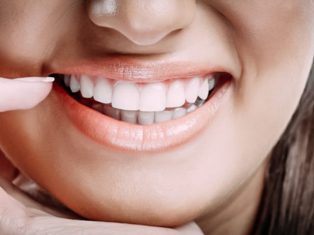 A shine and beautiful smile for patients who wants a great look.