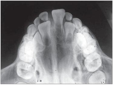 Dental X rays, is it necessary at the Dental Exam/checkups?