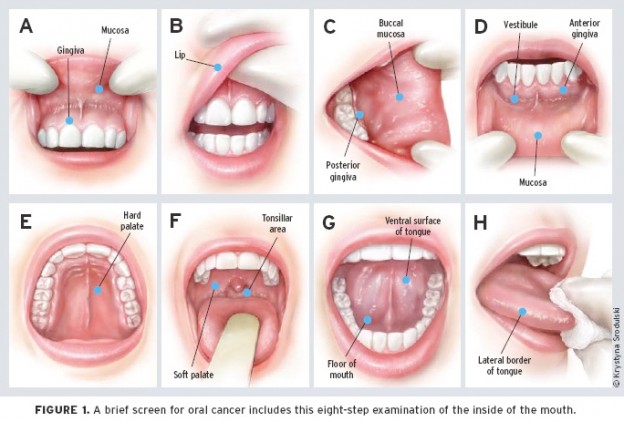 Dentistry & Oral Cancer