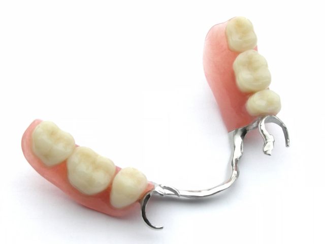 Removable Partial Dentures; How does it work?